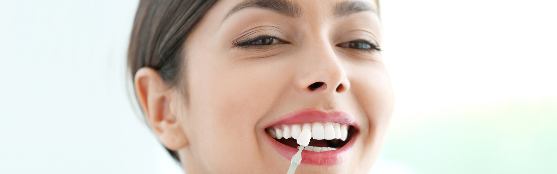 Dental Crowns in Mississauga, ON