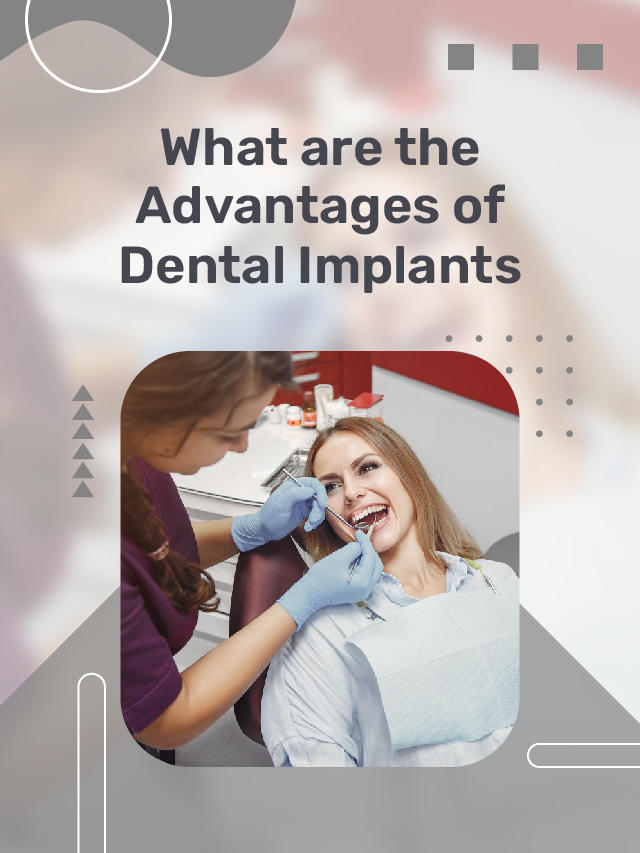 What are the Advantages of Dental Implants