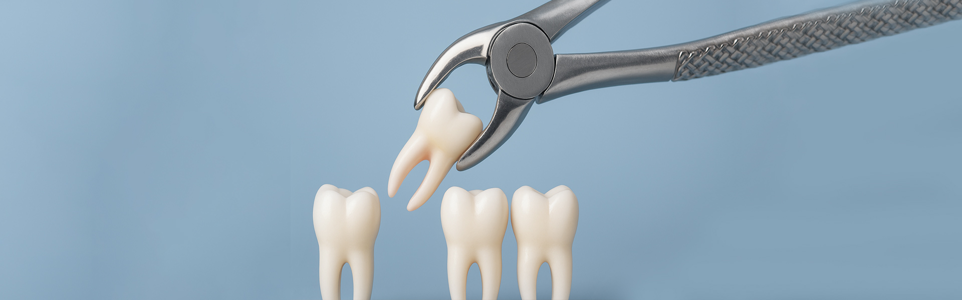 How Tooth Extractions Protect Your Smile