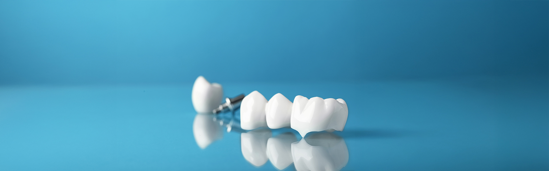 6 Reasons Why Dental Crowns Are Worth It